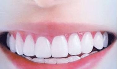 呢？衢州美萊整形美容醫(yī)院簡(jiǎn)介、技術(shù)優(yōu)勢(shì)、口碑在線查看！