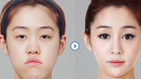 北京大學(xué)國(guó)際醫(yī)院整形外科醫(yī)生口碑如何？整形費(fèi)用合理嗎？