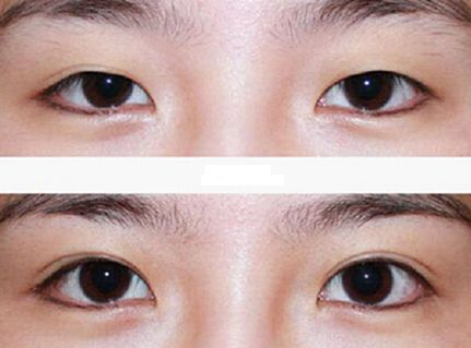 廣州整容鼻子技術(shù)排名前列的醫(yī)院有哪些？