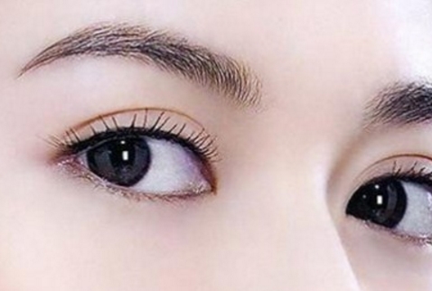 重慶天妃整形美容醫(yī)院：汪玉云的美瞳手術是否有效？