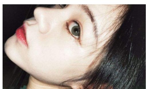 找一家靠譜的汕頭去除疤痕醫(yī)院？看這里！