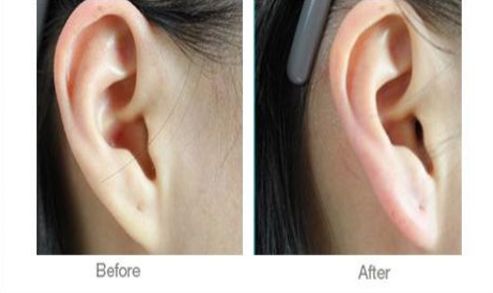 如何選擇西安哪家醫(yī)院術(shù)后康復(fù)好的機構(gòu)？