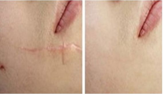 成都整容醫(yī)院哪家更專業(yè)靠譜？哪家整容醫(yī)院口碑好？