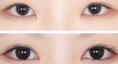 西安王者風范嫩膚哪家好？一文讀懂西安嫩膚機構(gòu)排行榜