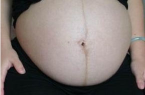 上海哪里有鼻修復專家？選擇困難癥仙女來了，點擊查看醫(yī)生介紹和價格！