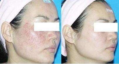 揭陽(yáng)市哪家醫(yī)院的美容整形技術(shù)最好？