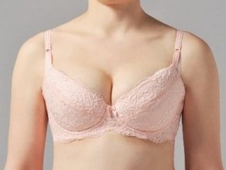 西京醫(yī)院雙眼皮修復(fù)值得選擇嗎？