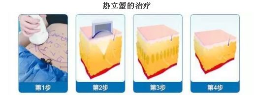 上海臉部祛斑哪家醫(yī)院好？揭秘上海市最受歡迎臉部祛斑醫(yī)院排行榜