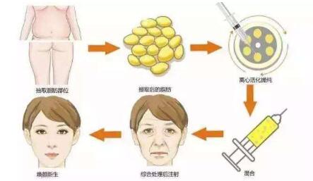 長沙鼻修復醫(yī)生推薦！多位專家實力PK，功力高出你的期待！最適合急需求的技術實力誰更強？