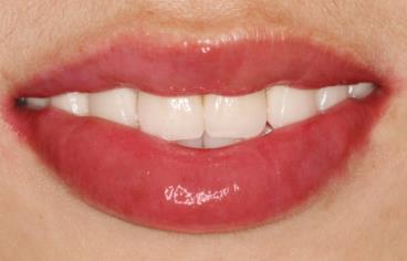 2023上海溶脂針瘦肩專家前十上榜名單(洪愷志、吳建明、陳兵技術(shù)強(qiáng)、價(jià)格低！)