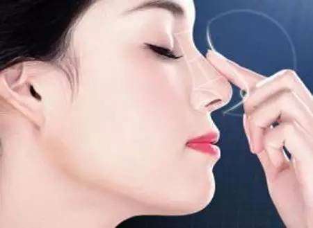 2023大連非假體隆鼻醫(yī)生口碑排行榜(沈文強(qiáng)、李菁、張弘發(fā)展時(shí)間久、經(jīng)驗(yàn)足)