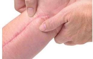 廣州哪家美容醫(yī)院好？詳細(xì)比較廣州頂級醫(yī)療機(jī)構(gòu)個美容醫(yī)院的優(yōu)缺點(diǎn)