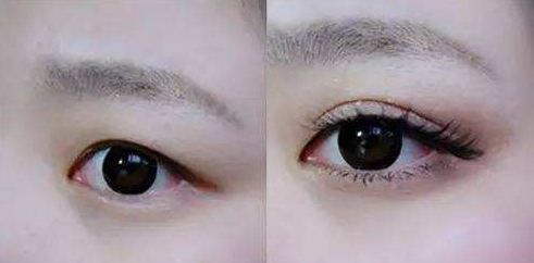 天津祛痘醫(yī)院哪家好？解決痘痘問(wèn)題，選擇最佳去痘醫(yī)院