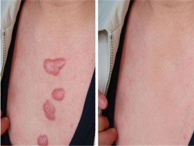 云南哪家整形醫(yī)院好？找個專業(yè)的才放心！