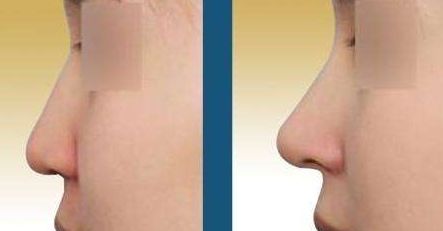 西安哪家皮膚美容機(jī)構(gòu)做得好？