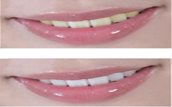 2023鄭州隔空溶脂瘦手臂正規(guī)醫(yī)生評價(jià)前10強(qiáng)(蔣秀娟、牛永敢、楊勝發(fā)個(gè)人簡介、技術(shù)優(yōu)勢分析！)