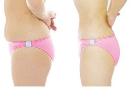 選擇衡陽哪家好的眼袋醫(yī)院？