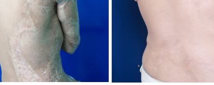 上海隆鼻哪家整形醫(yī)院好？權(quán)威醫(yī)生為您推薦的上海隆鼻醫(yī)院排行榜