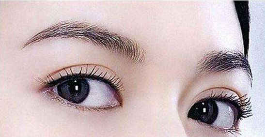 哪家成都醫(yī)院最適合取肉痣？專業(yè)醫(yī)療機(jī)構(gòu)推薦