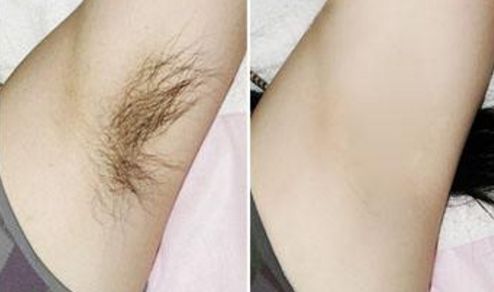 成都M唇做的好的醫(yī)院有哪些？