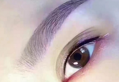 佟玲醫(yī)生的激光美容技術(shù)與祛痘疤案例解析！