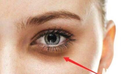 學(xué)會提升面部凹陷吧！病例分享，術(shù)后30天的終極效果。