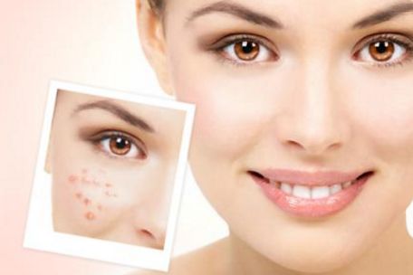 蘇州治療痘痘最好的醫(yī)院有哪些？