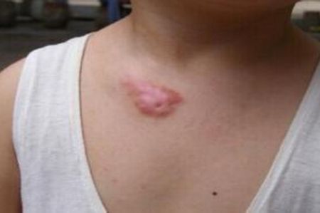 上海切眼袋手術(shù)醫(yī)院排名及口碑如何？