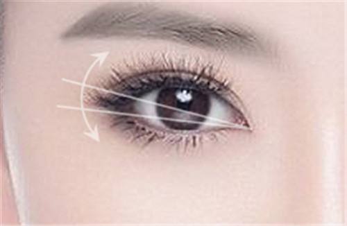 郭勇醫(yī)生的坐診地點及發(fā)際線種植案例，完美解決“禿頭少女”之困