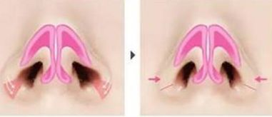 荊州美傲整形醫(yī)院門診有哪些擅長的項(xiàng)目？