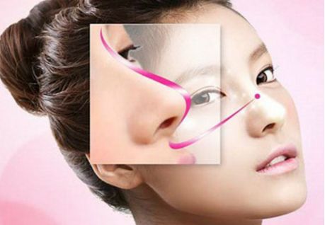 深圳駝峰鼻矯正哪家好？專業(yè)醫(yī)生推薦與真實(shí)案例分享！