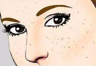 上海范榮杰醫(yī)生鼻部整形案例詳解，效果如何？