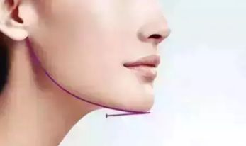 成都醫(yī)美做唇部哪家醫(yī)院好？找到這家醫(yī)院，告別唇部問題的困擾！