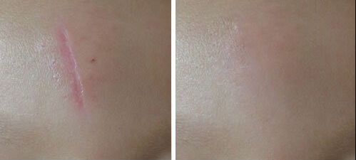 上海哪家整形醫(yī)院鼻子修復技術好