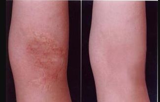 煙臺雙眼皮醫(yī)院哪家好？選專業(yè)技術(shù)高超、口碑好的醫(yī)院推薦