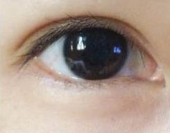 蘇州哪家祛痘醫(yī)院好？專家推薦的治療痘痘效果好的醫(yī)院