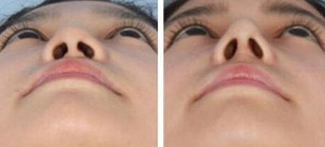 蘭州美容好的醫(yī)院是哪家？挑選最適合你的蘭州美容醫(yī)院