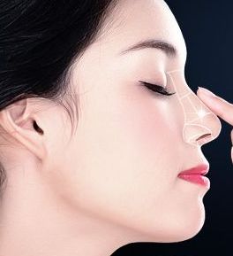 眼袋抽脂手術(shù)：整容效果深受好評