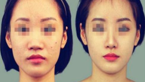 養(yǎng)成美鼻的6個(gè)關(guān)鍵步驟，完美修復(fù)效果在您的掌握！