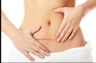 伊婉c玻尿酸讓你青春煥發(fā)，哪些部位最適合注射？