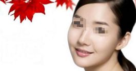 下巴整形手術(shù)有哪些方法？下頜角整形是否安全？