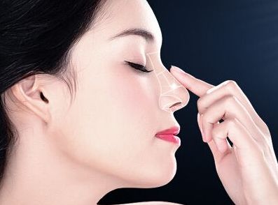 咬肌肥大切除手術費用是多少？探尋手術價格與成本