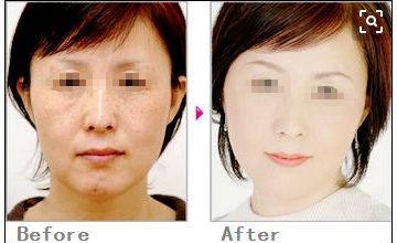 獨(dú)家分享！塌鼻子的完美發(fā)型指南，為你打造精致生活