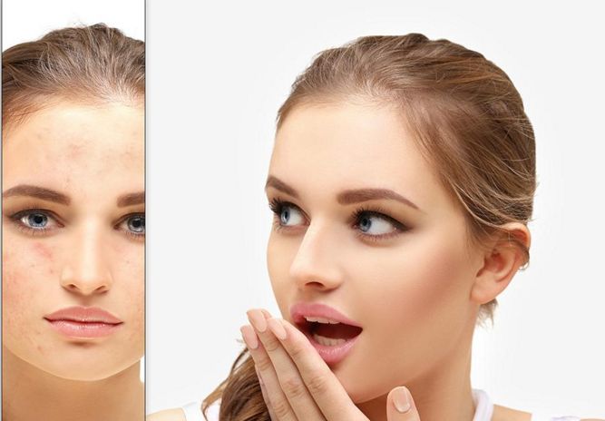 光子嫩膚效果如何？真實(shí)使用者分享經(jīng)驗(yàn)，告別皮膚問(wèn)題