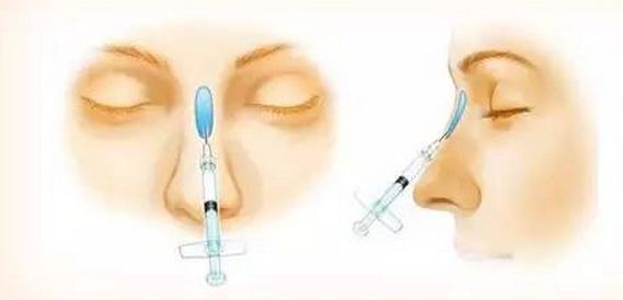 美白祛斑的方法有哪些？4種醫(yī)美美肌方案推薦