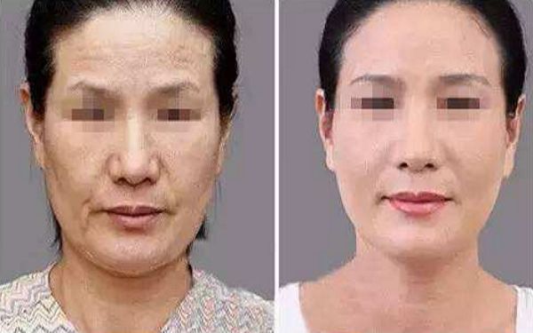 如何讓幼態(tài)臉變得緊致有型？塑造迷人圓潤(rùn)臉型攻略揭秘！