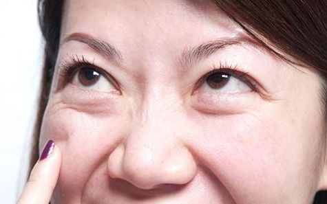 上海九院去眼袋專家推薦，最全擅長(zhǎng)項(xiàng)目及費(fèi)用一覽