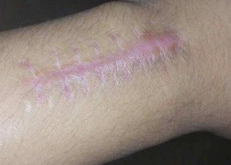 西安鼻子整形專家推薦：醫(yī)術(shù)高明的頂級醫(yī)生名錄