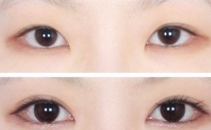 上海九院最佳雙眼皮整形專家排行榜揭曉