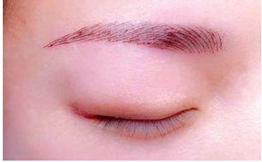 深圳醫(yī)生劉冰的鼻子整形效果如何？專業(yè)實力及成功案例發(fā)布